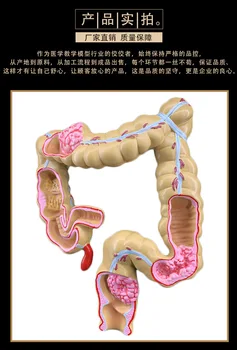 4D Vida Humana Tamanho do Cérebro anatomia órgãos Modelo Anatômico de Medicina do crânio do esqueleto anatômico Cólon Modelo com Patologias