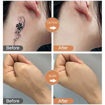 Tattoo Concealer Removedor De Tatuagem Profissional Impermeável Cicatriz Corretivo Lugares Escondidos Marcas De Maquiagem Creme Conjunto